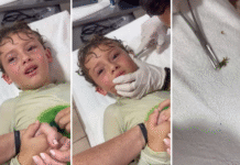 (VIDEO) “Del susto a la fama: niño mexicano con cangrejo en la oreja conquista TikTok”