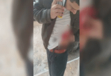 Ataque deja 2 heridos en pleno bulevar de Comalcalco.