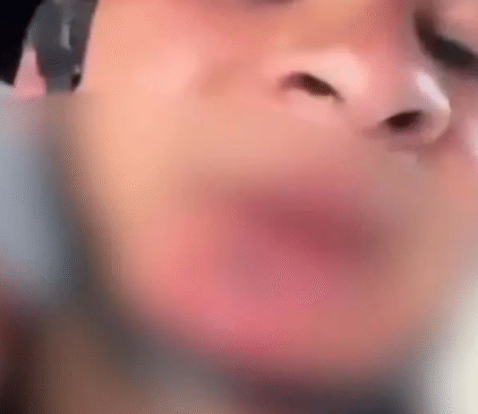 Difunden video de guardia herido tras operativo contra el CJNG.