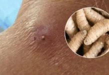 Tabasco suma siete casos de miasis por gusano barrenador.