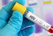 VIH crece 3% entre jóvenes tabasqueños sexualmente activos.
