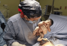 Tabasco estrena la primera Unidad de Cirugía Fetal.