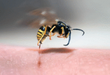 Temporada de calor multiplica picaduras de abejas