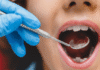 ¡Alarma dental! Seis de diez tienen caries: SETAB
