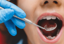 ¡Alarma dental! Seis de diez tienen caries: SETAB